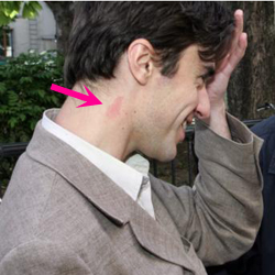 Lui, c'est Yann Wehrling, l'inconnu qui a succédé à Gilles Lemaire. il a un suçon dans le cou. Il suscite l'affection. Pourtant, professionnellement il écrit des histoires pour enfants avec une morale environnementale, c'est hyper terne. Et puis sa coupe de cheveux please on est plus à Stan.